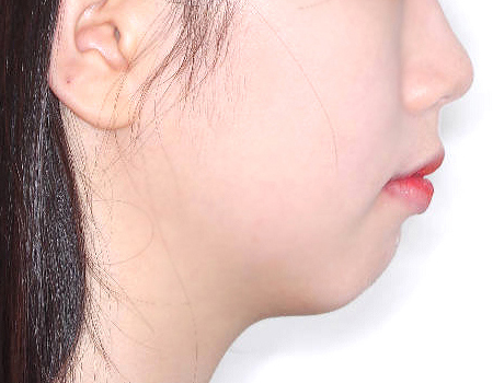 슬라이드1