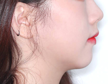 슬라이드4