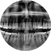 X-RAY 안면사진, 구강사진